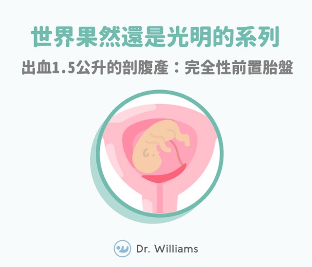 世界果然還是光明的系列:出血1.5公升的剖腹產