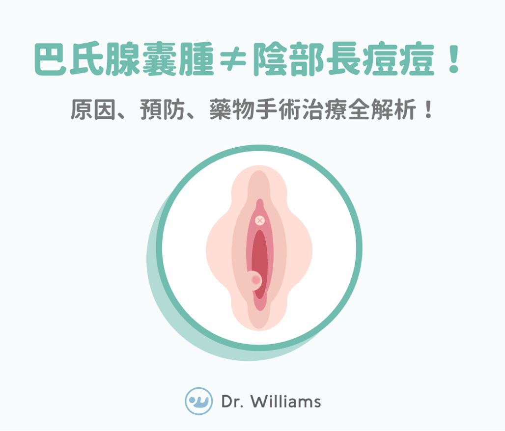 巴氏腺囊腫≠陰部長痘痘！原因、預防、藥物手術治療全解析！