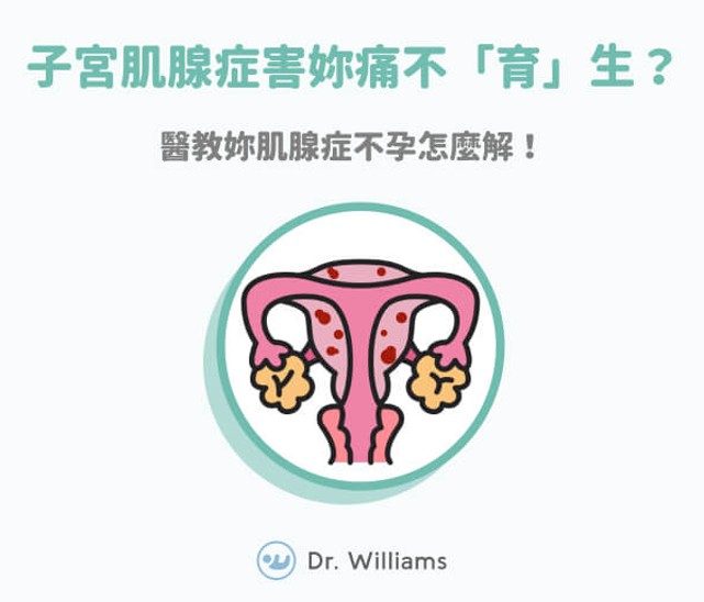 子宮肌腺症害妳痛不「育」生？醫教妳肌腺症不孕怎麼解！