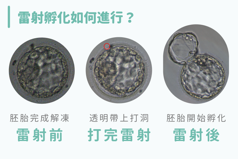 雷射孵化如何進行?