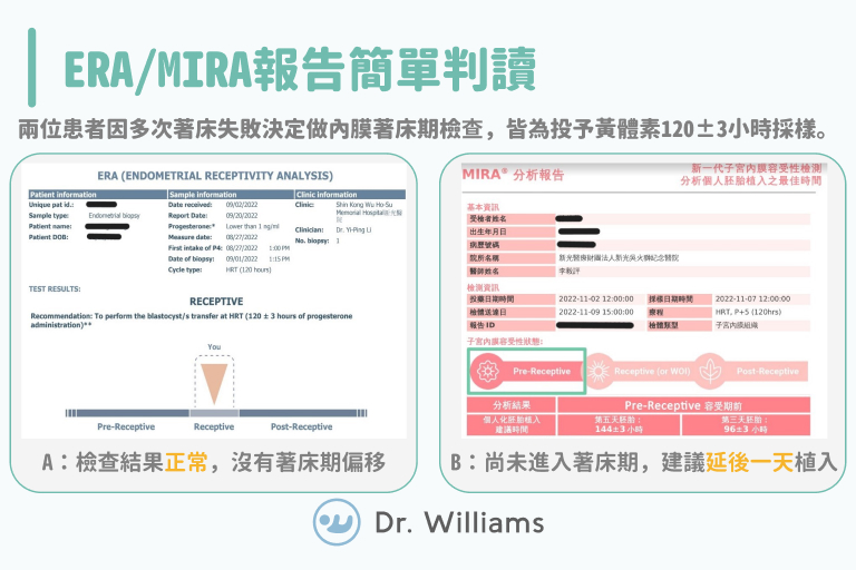 ERA/MIRA報告簡單判讀