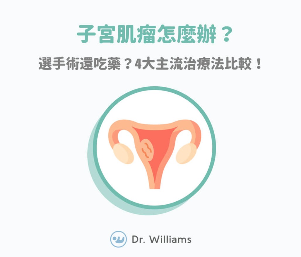 子宮肌瘤怎麼辦？選手術還吃藥？4大主流治療法比較！