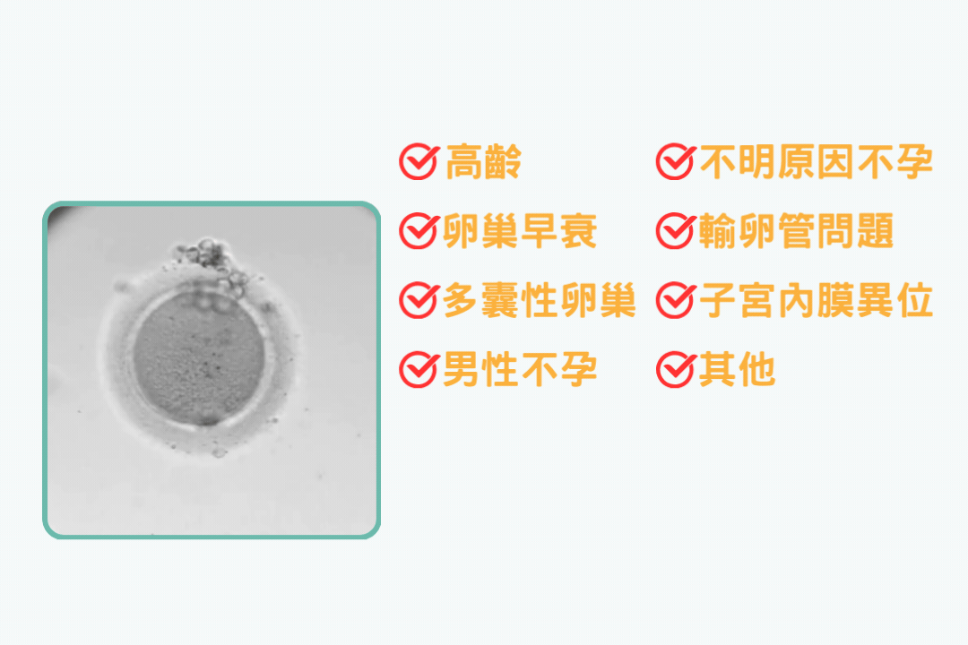 胚胎縮時攝影適合什麼哪些人?