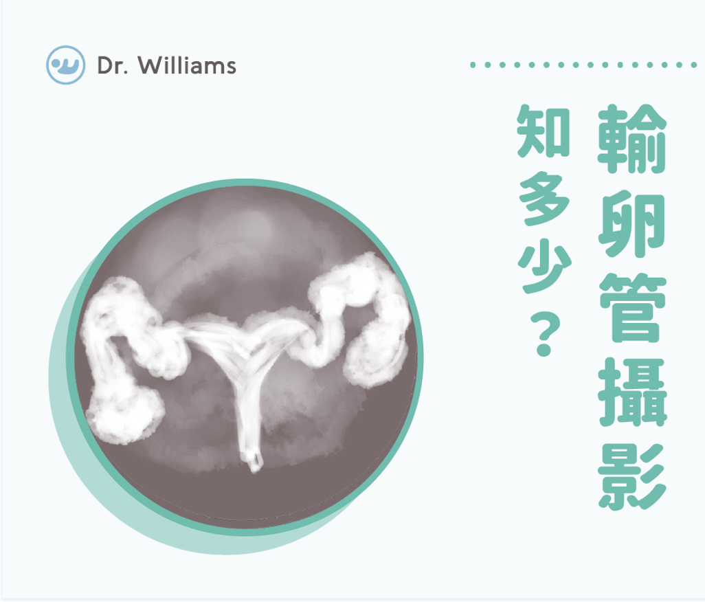 輸卵管攝影知多少？三個輸卵管攝影疼痛原因大解析！