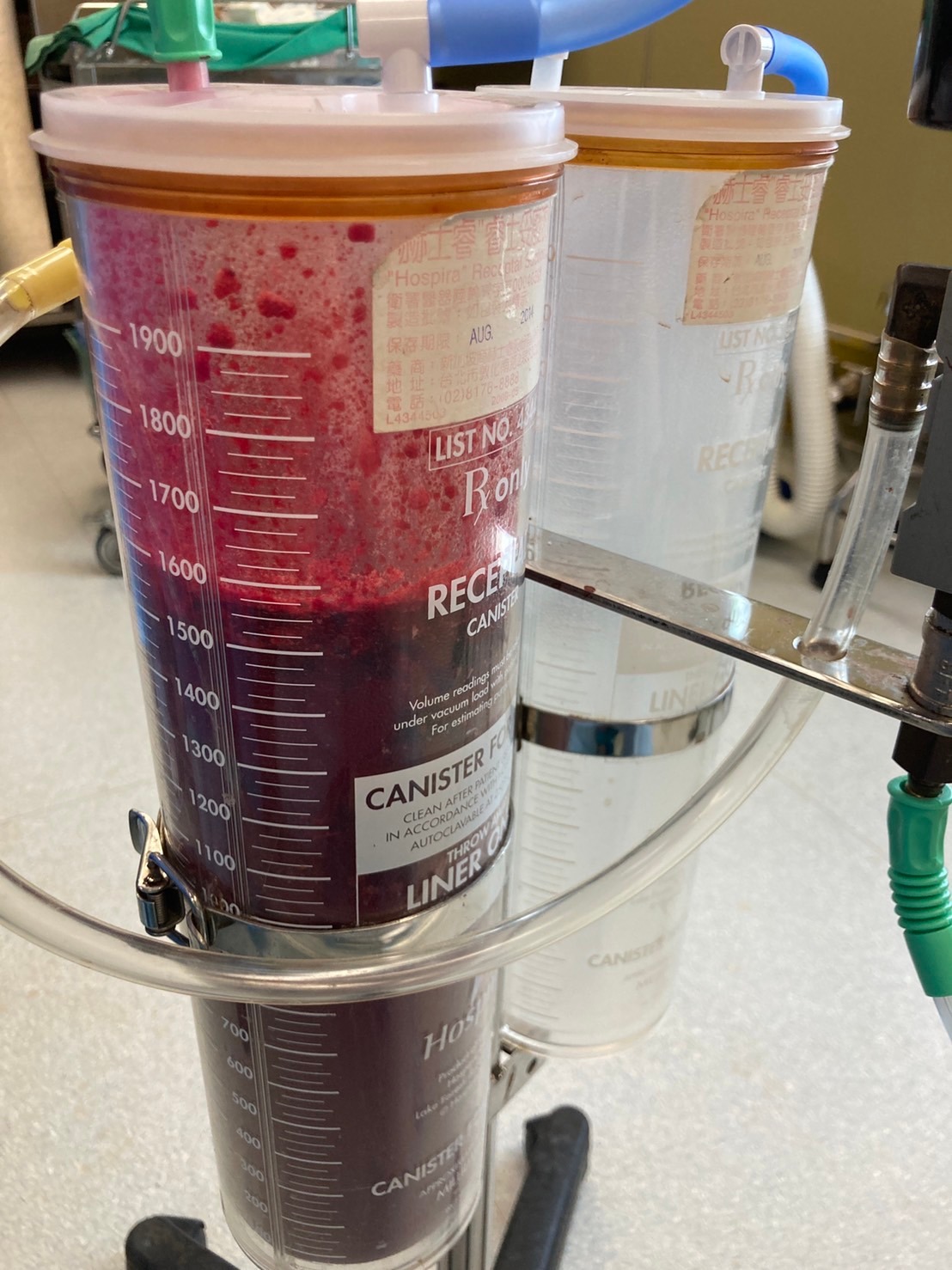 小魚的前置胎盤並沒有合併植入性胎盤,最終出血1,500CC,順利生出3,000多克的小男生。