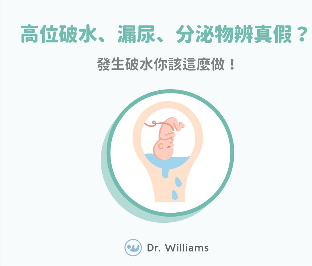高位破水、漏尿、分泌物辨真假？發生破水你該這麼做！