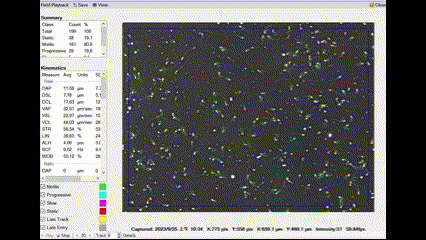 電腦輔助精蟲動力分析儀（CASA）精液檢查畫面